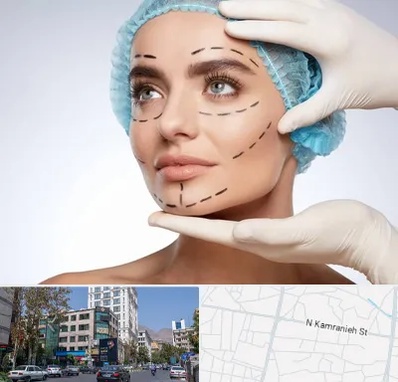 جراحی زیبایی در کامرانیه
