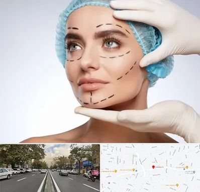 جراحی زیبایی در دولت