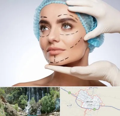 جراحی زیبایی در شیروان