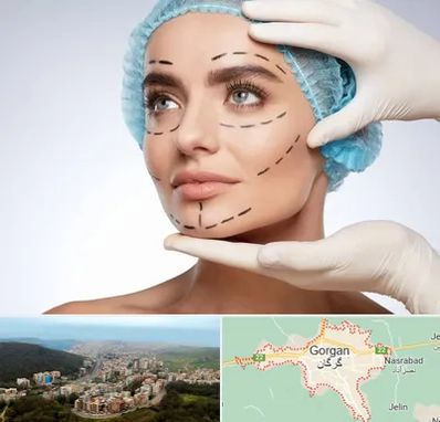 جراحی زیبایی در گرگان