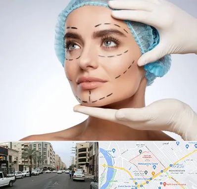 جراحی زیبایی در زیتون کارمندی اهواز