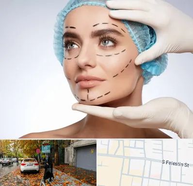 جراحی زیبایی در خیابان فلسطین