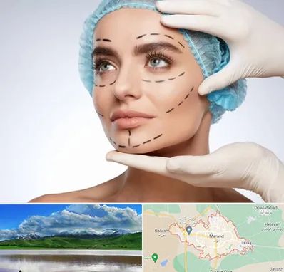 جراحی زیبایی در مرند