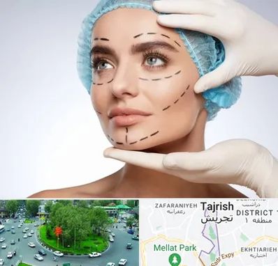 جراحی زیبایی در تجریش