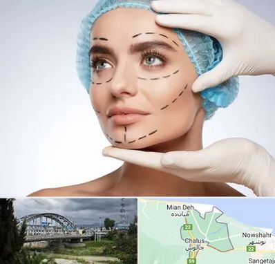 جراحی زیبایی در چالوس