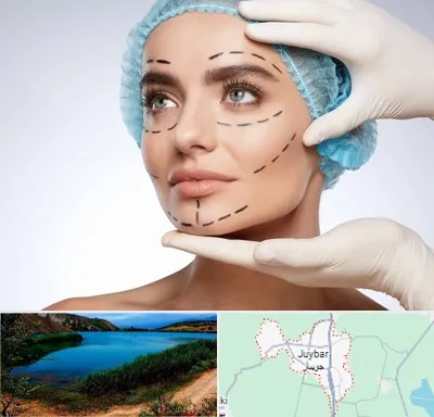 جراحی زیبایی در جویبار