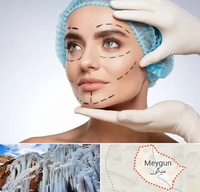 جراحی زیبایی در میگون