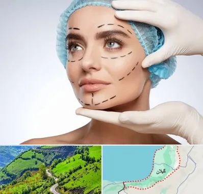 جراحی زیبایی در گیلان