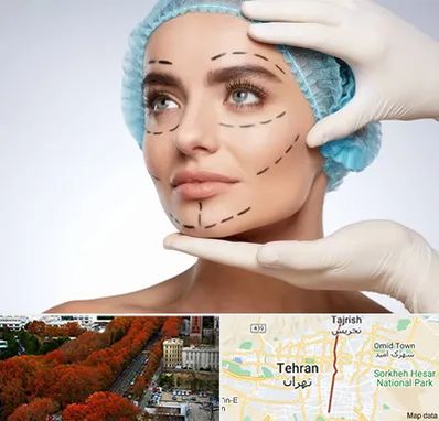 جراحی زیبایی در ولیعصر