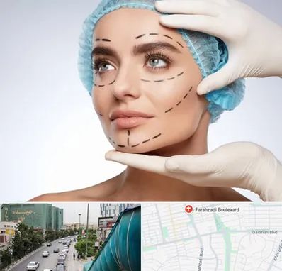 جراحی زیبایی در بلوار فرحزادی