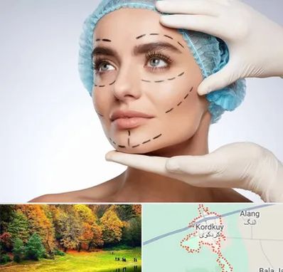 جراحی زیبایی در کردکوی