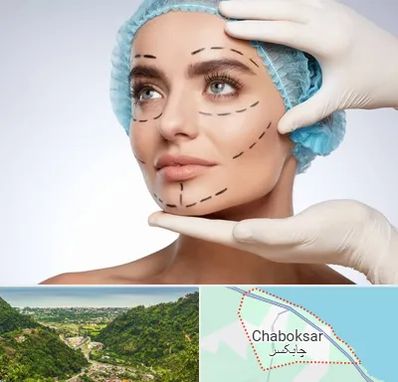 جراحی زیبایی در چابکسر