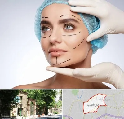 جراحی زیبایی در دزاشیب