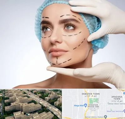جراحی زیبایی در اکباتان