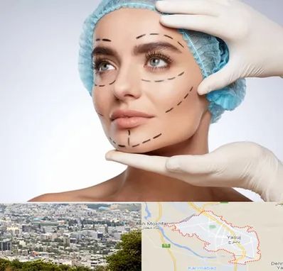 جراحی زیبایی در یاسوج