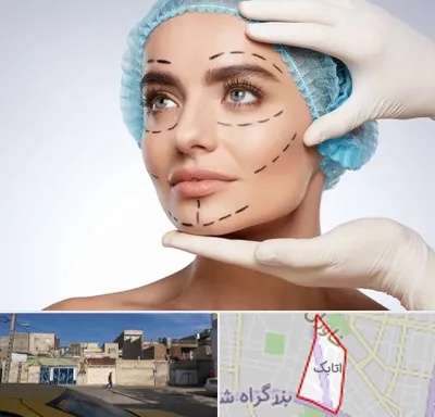 جراحی زیبایی در اتابک