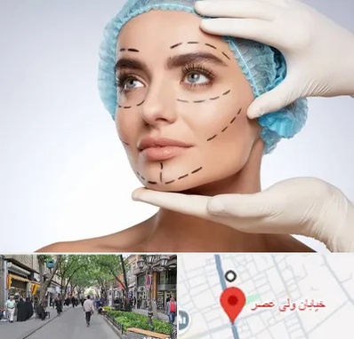 جراحی زیبایی در ولیعصر شهریار