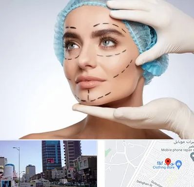 جراحی زیبایی در چهارراه طالقانی کرج