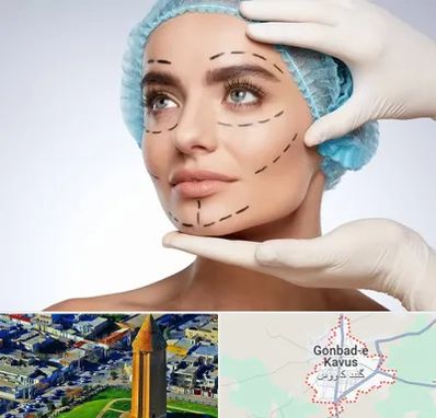 جراحی زیبایی در گنبد کاووس
