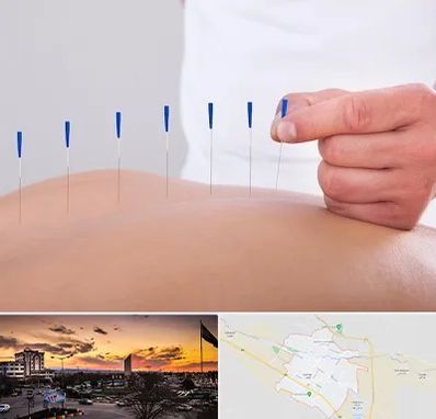 دکتر طب سوزنی در قوچان