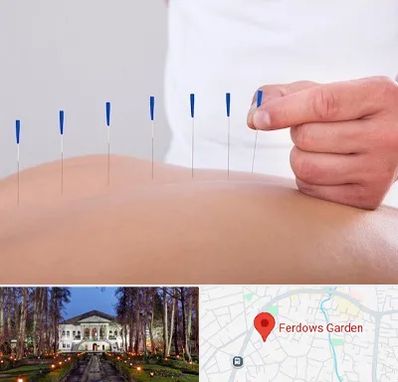 دکتر طب سوزنی در باغ فردوس