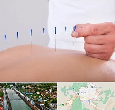 دکتر طب سوزنی در مراغه