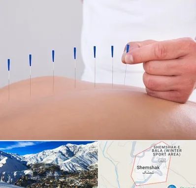 دکتر طب سوزنی در شمشک