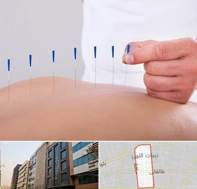 دکتر طب سوزنی در نجات اللهی