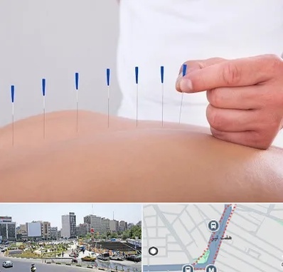 دکتر طب سوزنی در هفت تیر