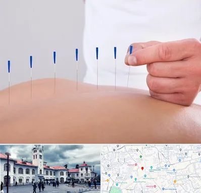 دکتر طب سوزنی در میدان شهرداری رشت