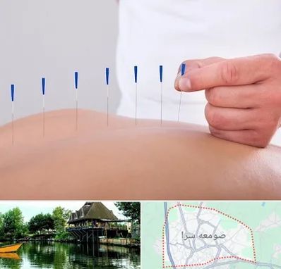 دکتر طب سوزنی در صومعه سرا