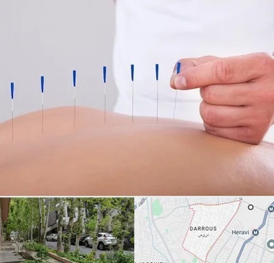 دکتر طب سوزنی در دروس