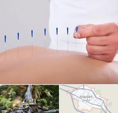 دکتر طب سوزنی در الیگودرز