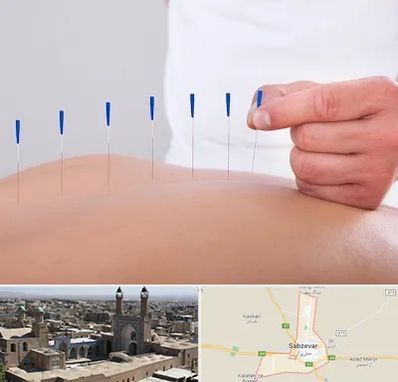 دکتر طب سوزنی در سبزوار