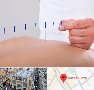 دکتر طب سوزنی در بازار رضا مشهد