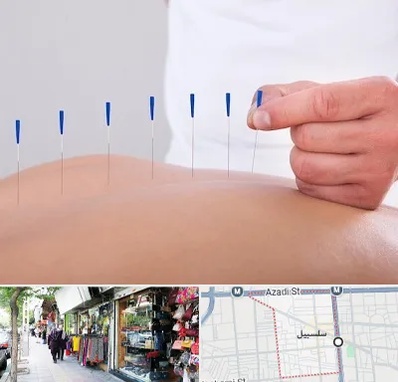 دکتر طب سوزنی در سلسبیل