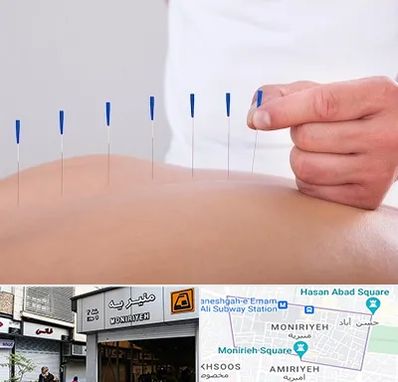 دکتر طب سوزنی در منیریه