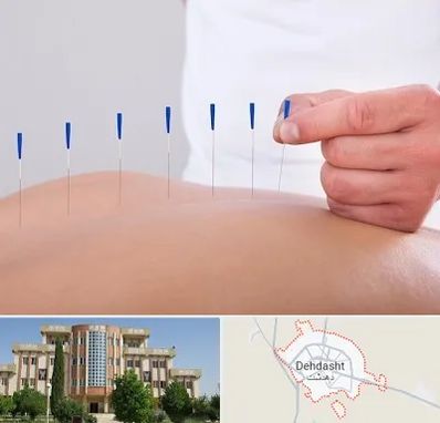 دکتر طب سوزنی در دهدشت