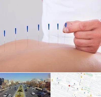 دکتر طب سوزنی در بلوار معلم مشهد