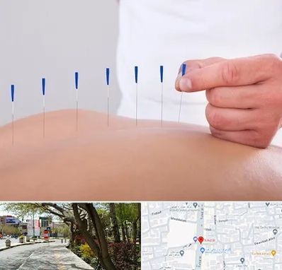 دکتر طب سوزنی در خیابان توحید اصفهان