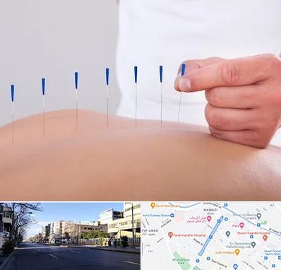 دکتر طب سوزنی در خیابان ملاصدرا شیراز