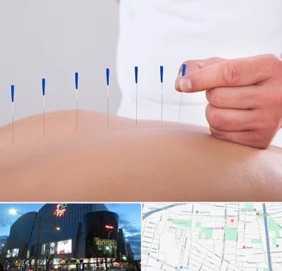 دکتر طب سوزنی در بلوار اباذر