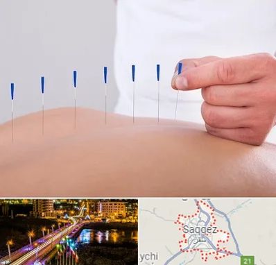 دکتر طب سوزنی در سقز