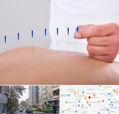 دکتر طب سوزنی در فاطمی