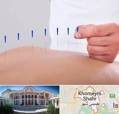 دکتر طب سوزنی در خمینی شهر