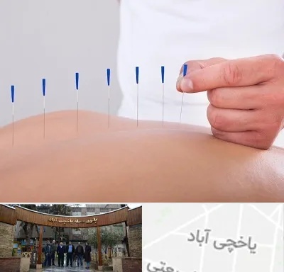 دکتر طب سوزنی در یاخچی آباد