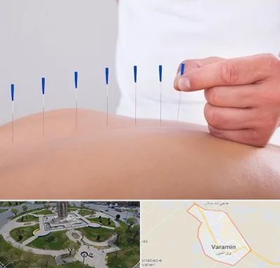دکتر طب سوزنی در ورامین