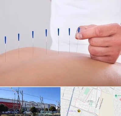 دکتر طب سوزنی در فاز دو اندیشه