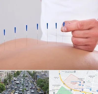 دکتر طب سوزنی در گلشهر کرج