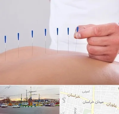 دکتر طب سوزنی در میدان خراسان